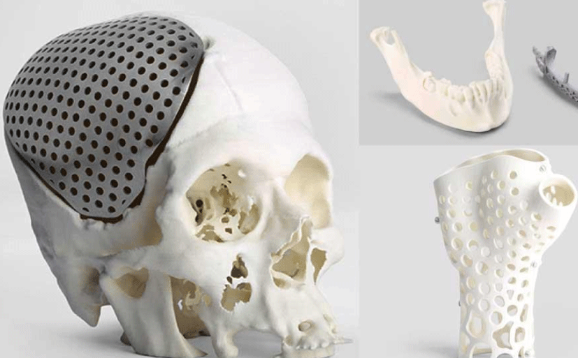 3D Printing